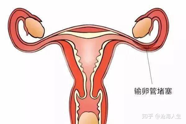 通草的功效与作用能通输卵管堵塞,重要性解释落实方法_X版48.54